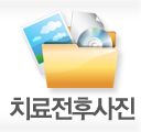 치료전후사진